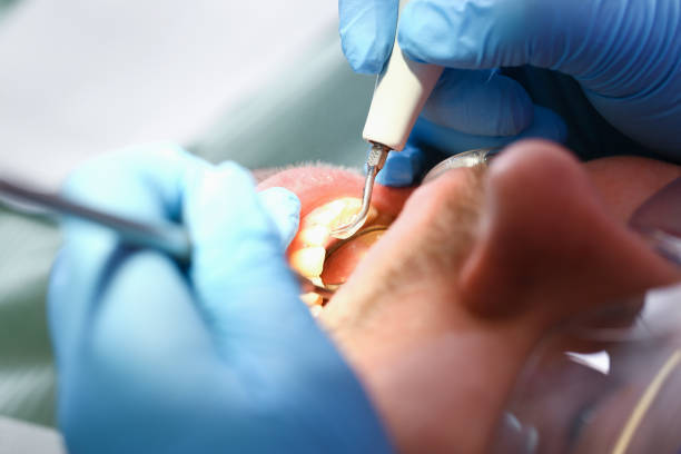 Best Weekend Emergency Dentist in Jackson Center, OH