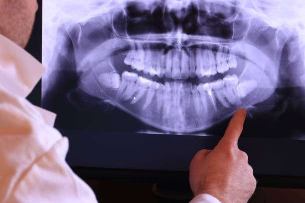 Best Emergency Tooth Extraction in Jackson Center, OH