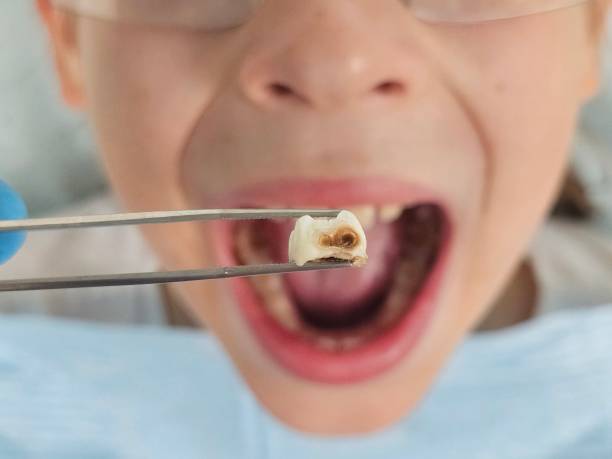 Best Walk-In Emergency Dentist in Jackson Center, OH